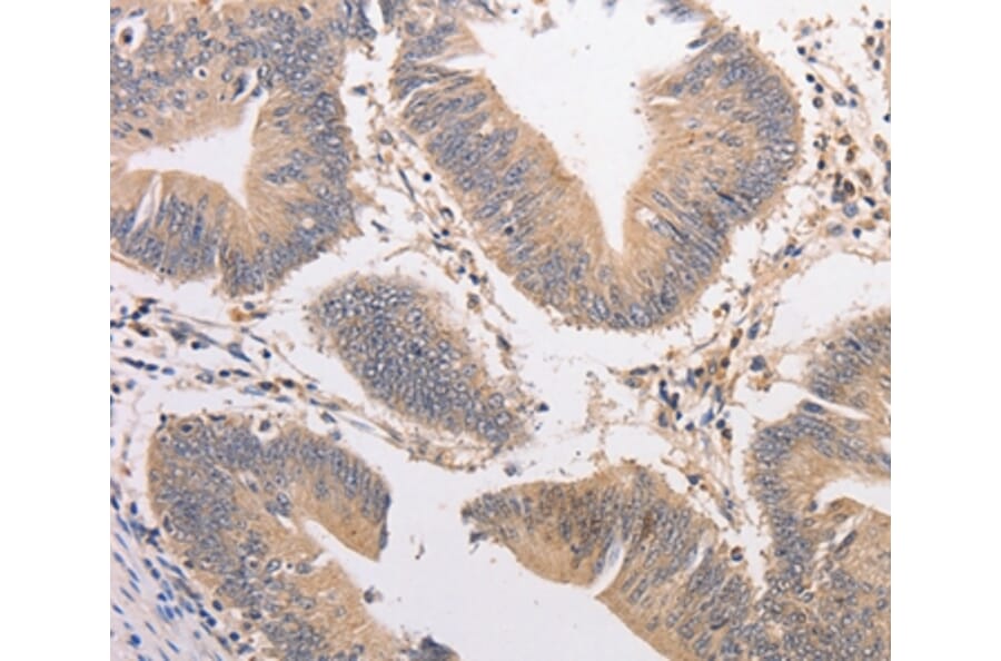 Immunohistochemistry - PIP5K1A Antibody from Signalway Antibody (36206) - Antibodies.com