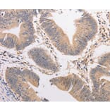 Immunohistochemistry - PIP5K1A Antibody from Signalway Antibody (36206) - Antibodies.com