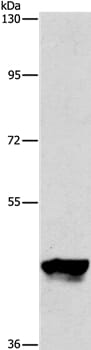 Gel: 10% SDS-PAGE Lysate: 40ug K562 cell Primary antibody: 1/950 dilution Secondary antibody dilution: 1/8000 Exposure time: 1 minute