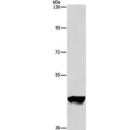PIP4K2A Antibody from Signalway Antibody (36235) - Antibodies.com