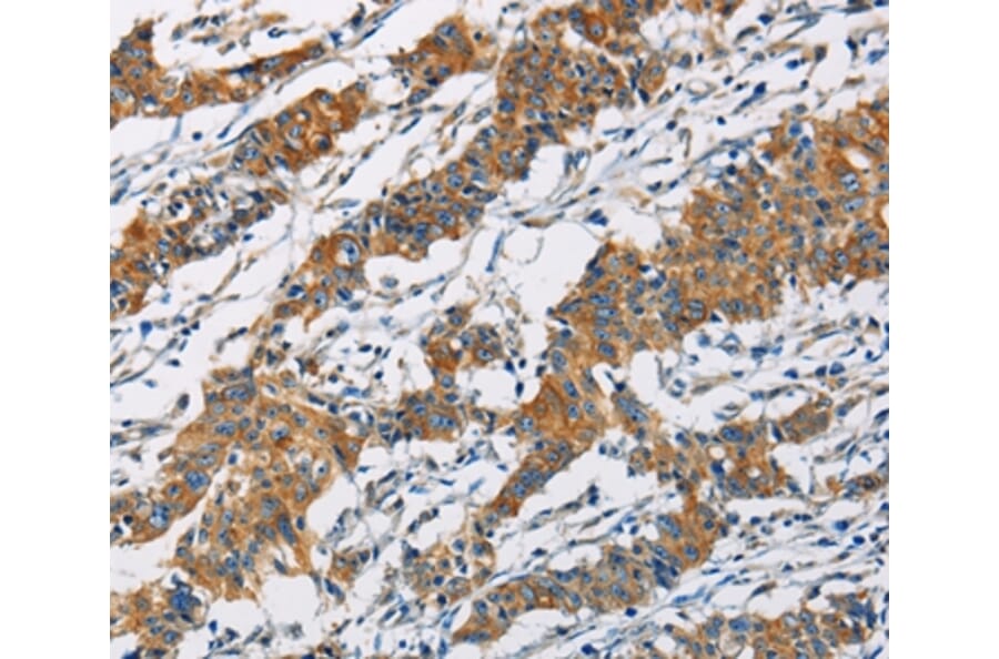 Immunohistochemistry - PIP4K2A Antibody from Signalway Antibody (36235) - Antibodies.com