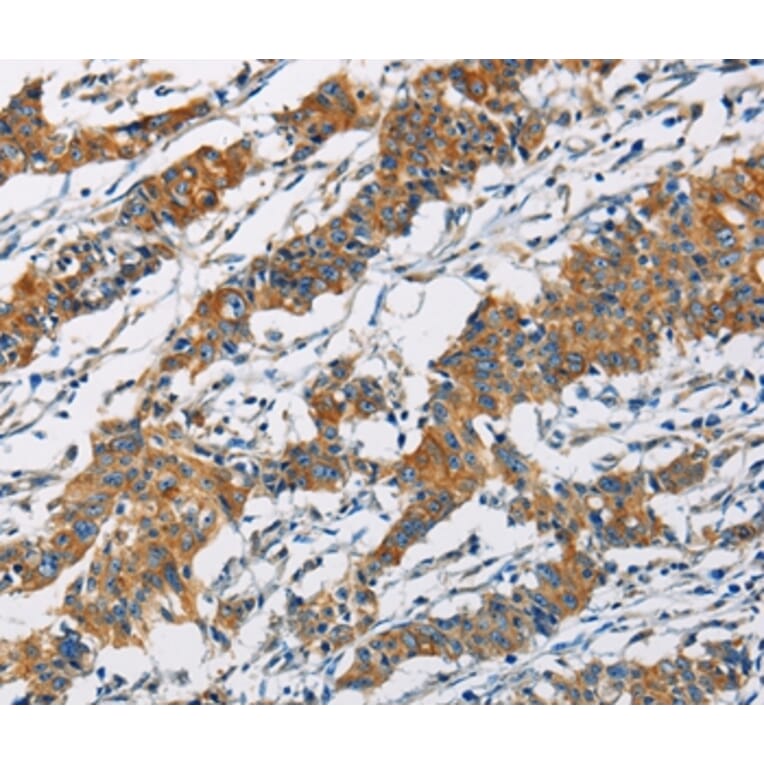 Immunohistochemistry - PIP4K2A Antibody from Signalway Antibody (36235) - Antibodies.com