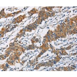 Immunohistochemistry - PIP4K2A Antibody from Signalway Antibody (36235) - Antibodies.com