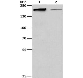TP53BP2 Antibody from Signalway Antibody (36266) - Antibodies.com