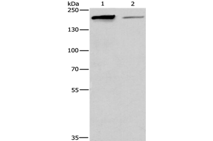TP53BP2 Antibody from Signalway Antibody (36266) - Antibodies.com