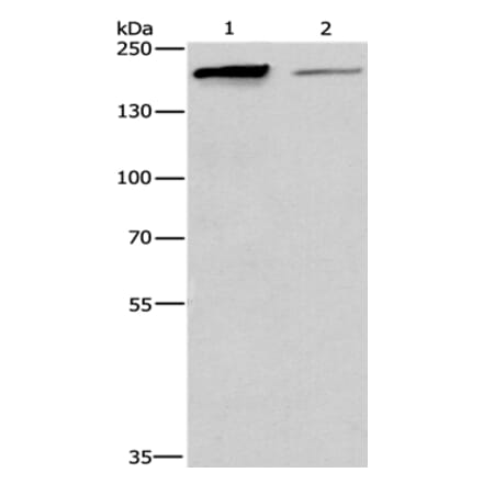 TP53BP2 Antibody from Signalway Antibody (36266) - Antibodies.com