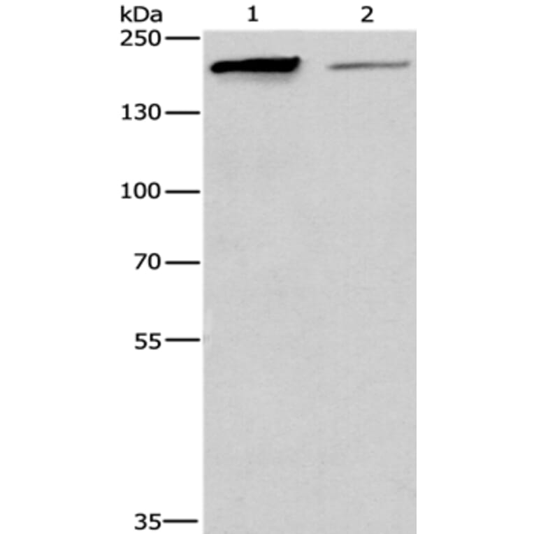 TP53BP2 Antibody from Signalway Antibody (36266) - Antibodies.com