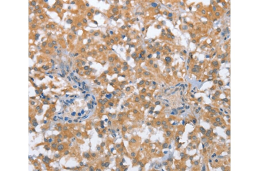 Immunohistochemistry - TP53BP2 Antibody from Signalway Antibody (36266) - Antibodies.com