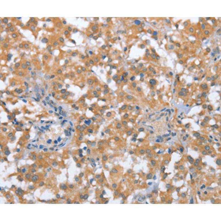 Immunohistochemistry - TP53BP2 Antibody from Signalway Antibody (36266) - Antibodies.com