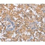 Immunohistochemistry - TP53BP2 Antibody from Signalway Antibody (36266) - Antibodies.com