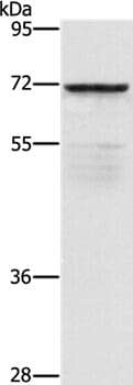 Gel: 8% SDS-PAGE Lysate: 40ug 231 cell Primary antibody: 1/550 dilution Secondary antibody dilution: 1/8000 Exposure time: 1 minute