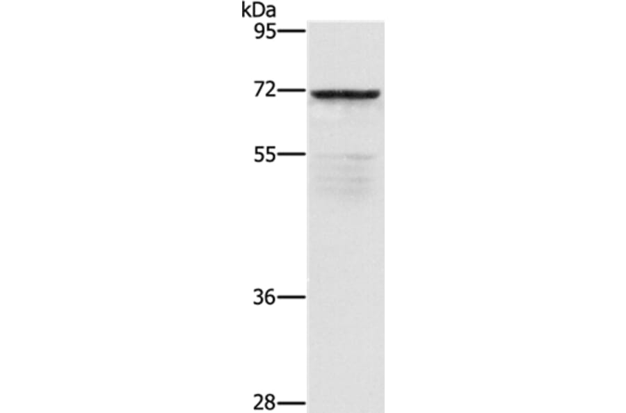 ZMYND11 Antibody from Signalway Antibody (36292) - Antibodies.com