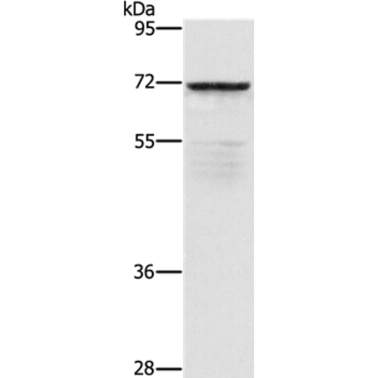 ZMYND11 Antibody from Signalway Antibody (36292) - Antibodies.com