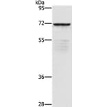 ZMYND11 Antibody from Signalway Antibody (36292) - Antibodies.com