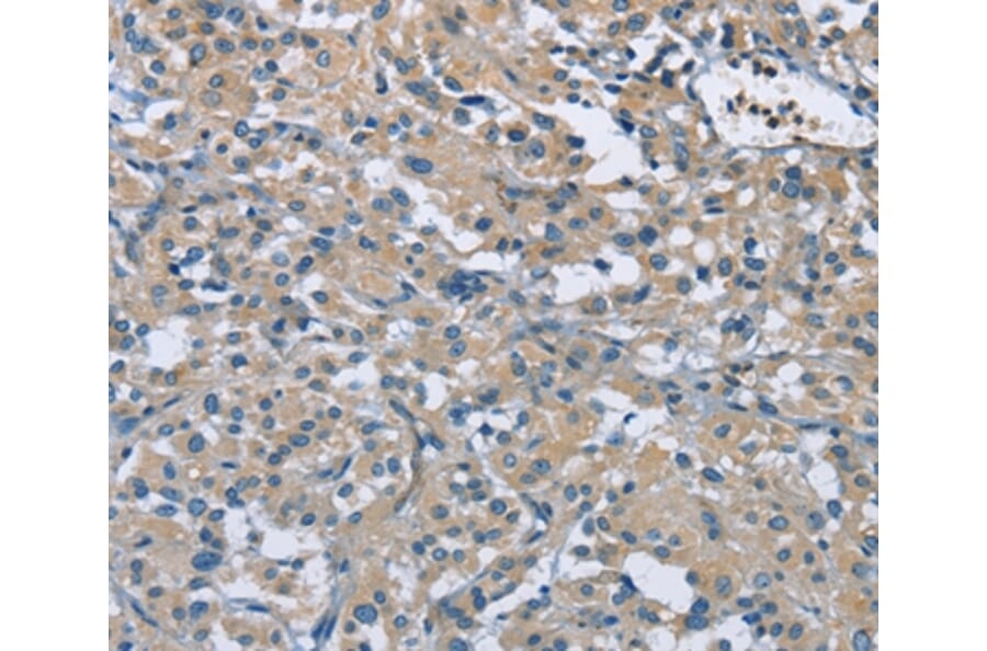 Immunohistochemistry - ZMYND11 Antibody from Signalway Antibody (36292) - Antibodies.com