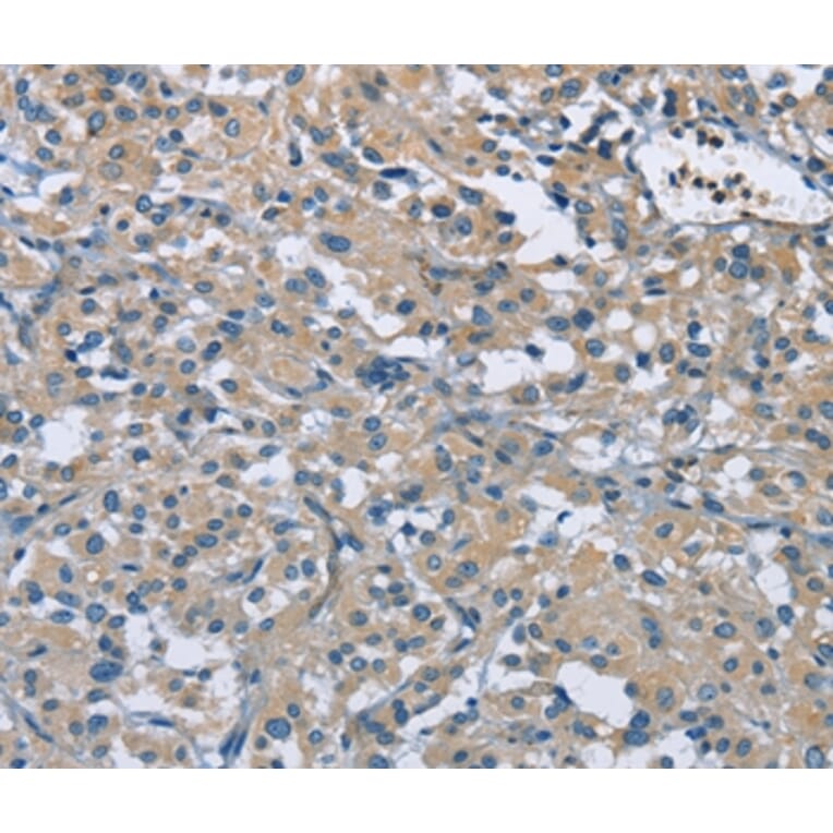 Immunohistochemistry - ZMYND11 Antibody from Signalway Antibody (36292) - Antibodies.com