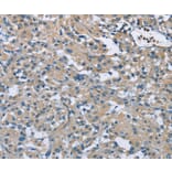 Immunohistochemistry - ZMYND11 Antibody from Signalway Antibody (36292) - Antibodies.com