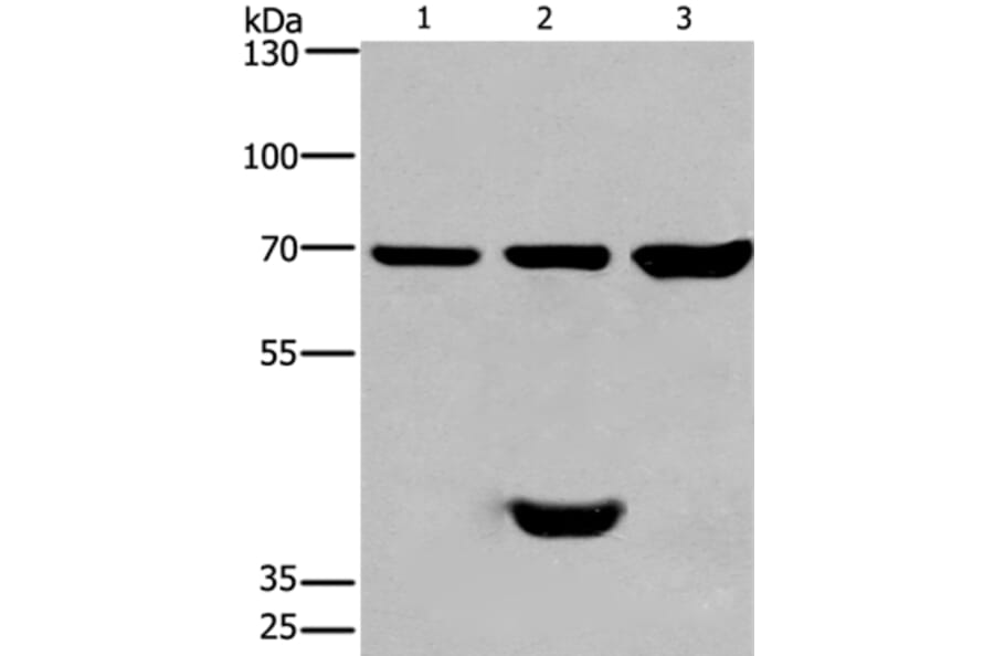 CABLES1 Antibody from Signalway Antibody (36296) - Antibodies.com