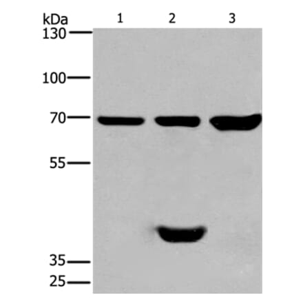 CABLES1 Antibody from Signalway Antibody (36296) - Antibodies.com