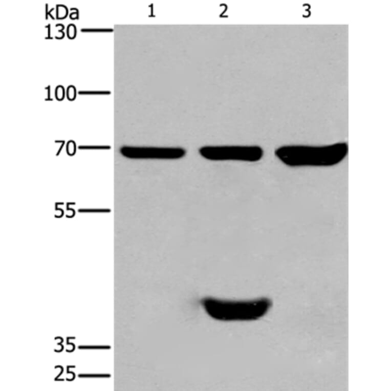 CABLES1 Antibody from Signalway Antibody (36296) - Antibodies.com