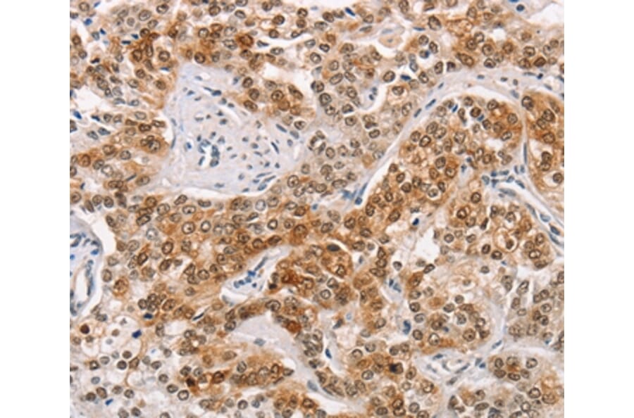 Immunohistochemistry - CABLES1 Antibody from Signalway Antibody (36296) - Antibodies.com