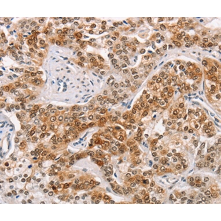 Immunohistochemistry - CABLES1 Antibody from Signalway Antibody (36296) - Antibodies.com