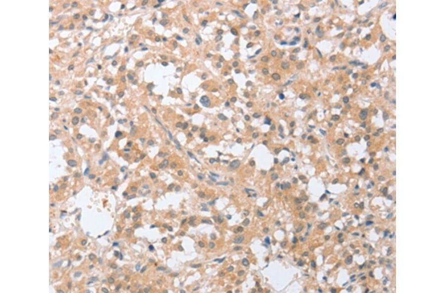 Immunohistochemistry - SIGLEC9 Antibody from Signalway Antibody (36329) - Antibodies.com