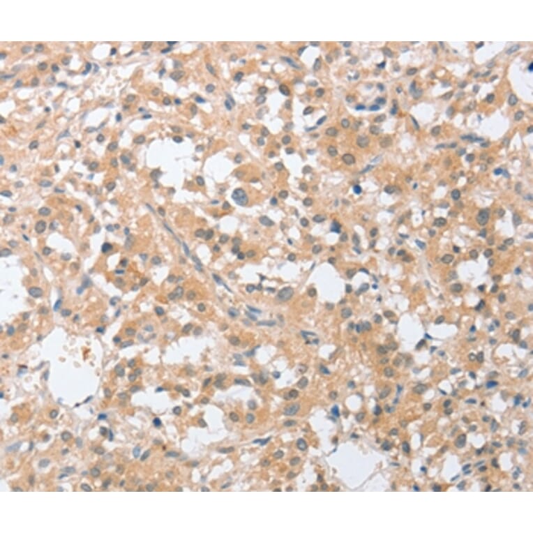 Immunohistochemistry - SIGLEC9 Antibody from Signalway Antibody (36329) - Antibodies.com
