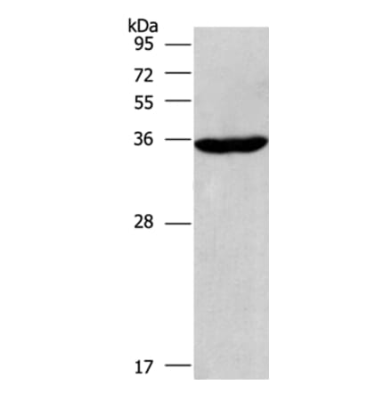CIAPIN1 Antibody from Signalway Antibody (36352) - Antibodies.com