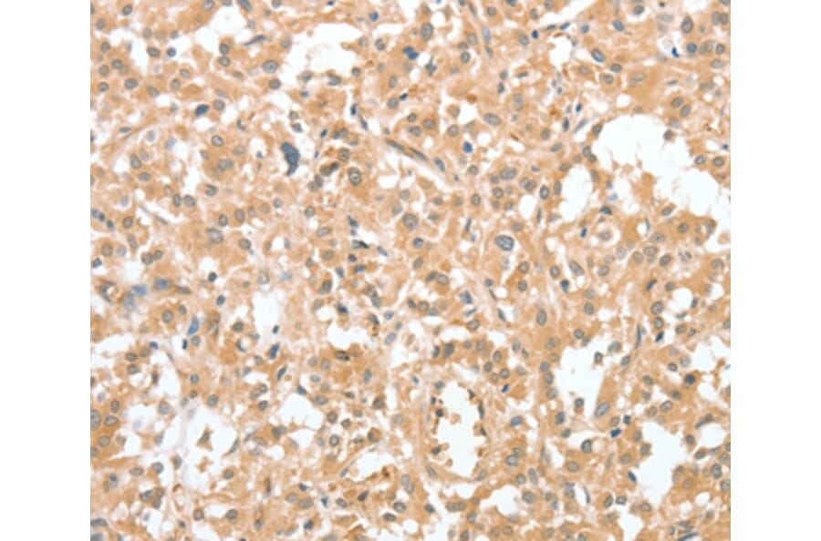 Immunohistochemistry - CIAPIN1 Antibody from Signalway Antibody (36352) - Antibodies.com