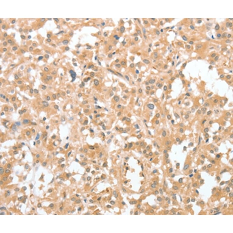 Immunohistochemistry - CIAPIN1 Antibody from Signalway Antibody (36352) - Antibodies.com