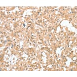 Immunohistochemistry - CIAPIN1 Antibody from Signalway Antibody (36352) - Antibodies.com