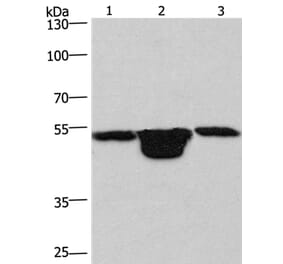 PLEKHO1 Antibody from Signalway Antibody (36356) - Antibodies.com