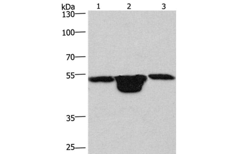 PLEKHO1 Antibody from Signalway Antibody (36356) - Antibodies.com