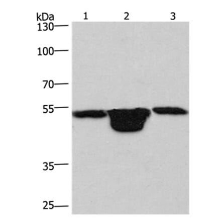 PLEKHO1 Antibody from Signalway Antibody (36356) - Antibodies.com