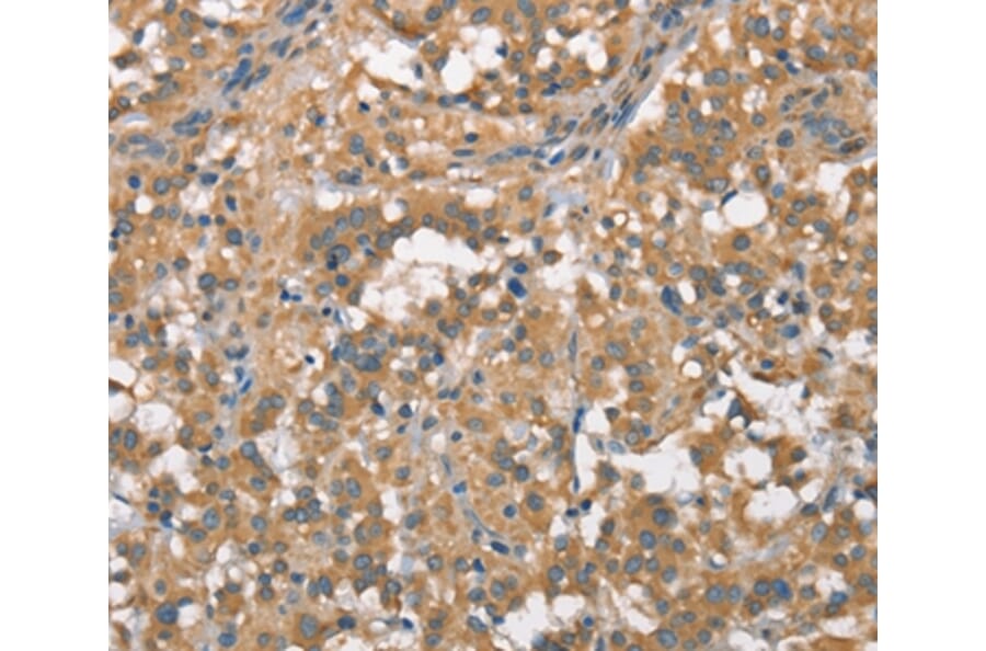 Immunohistochemistry - PLEKHO1 Antibody from Signalway Antibody (36356) - Antibodies.com