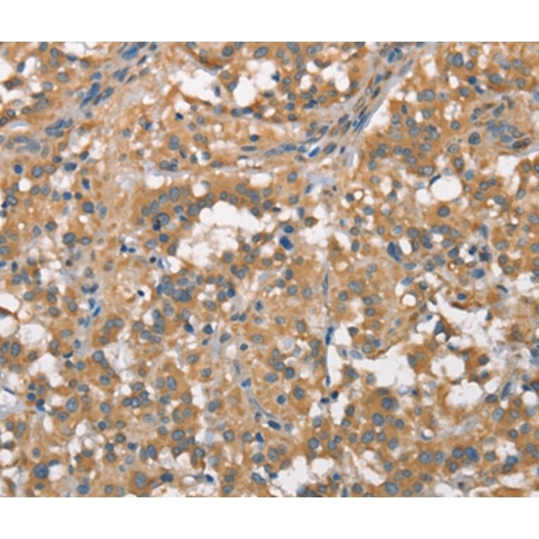 Immunohistochemistry - PLEKHO1 Antibody from Signalway Antibody (36356) - Antibodies.com