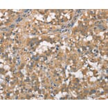 Immunohistochemistry - PLEKHO1 Antibody from Signalway Antibody (36356) - Antibodies.com