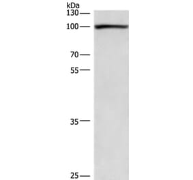 PLA2G4A Antibody from Signalway Antibody (36366) - Antibodies.com