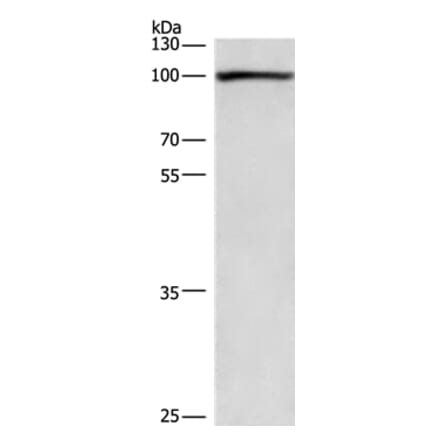 PLA2G4A Antibody from Signalway Antibody (36366) - Antibodies.com