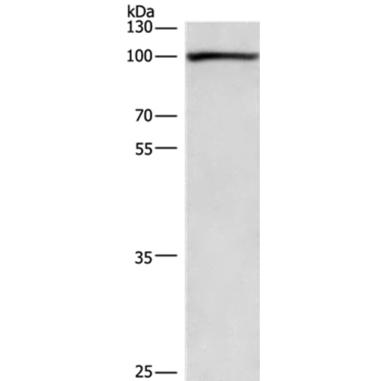 PLA2G4A Antibody from Signalway Antibody (36366) - Antibodies.com