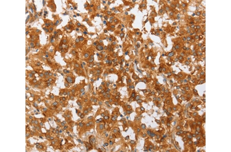 Immunohistochemistry - PLA2G4A Antibody from Signalway Antibody (36366) - Antibodies.com