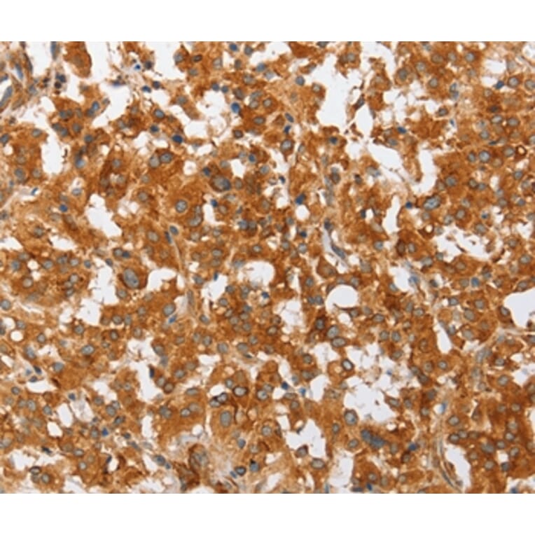 Immunohistochemistry - PLA2G4A Antibody from Signalway Antibody (36366) - Antibodies.com