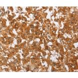 Immunohistochemistry - PLA2G4A Antibody from Signalway Antibody (36366) - Antibodies.com