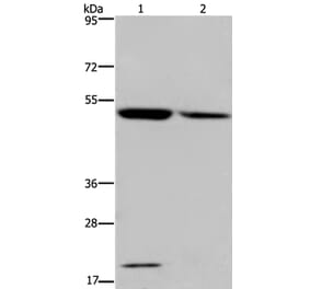 CYP27A1 Antibody from Signalway Antibody (36387) - Antibodies.com