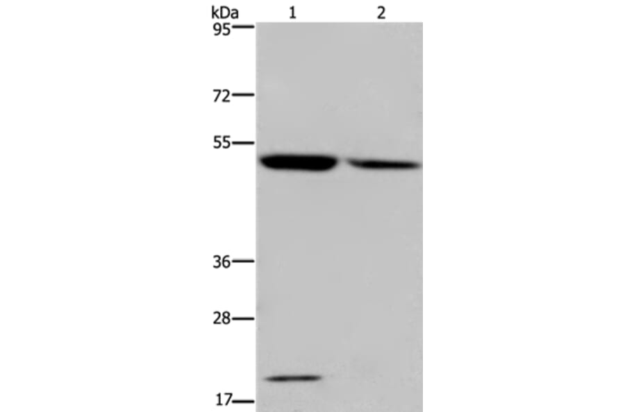 CYP27A1 Antibody from Signalway Antibody (36387) - Antibodies.com