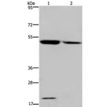 CYP27A1 Antibody from Signalway Antibody (36387) - Antibodies.com