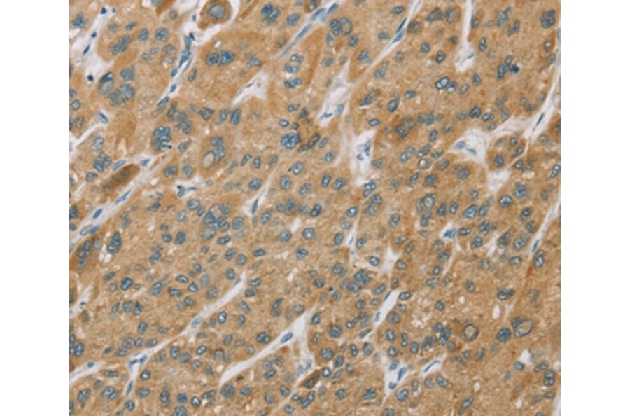 Immunohistochemistry - CYP27A1 Antibody from Signalway Antibody (36387) - Antibodies.com