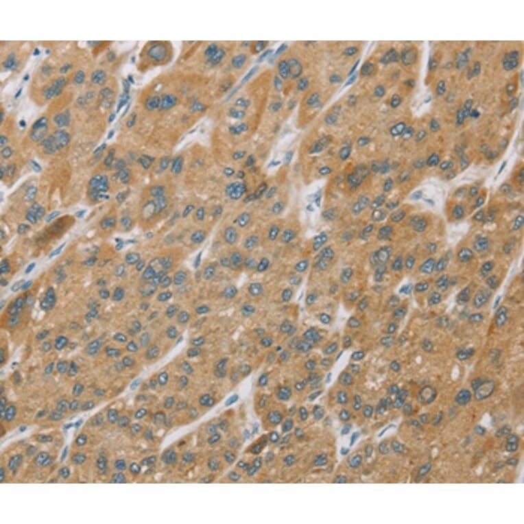 Immunohistochemistry - CYP27A1 Antibody from Signalway Antibody (36387) - Antibodies.com