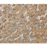 Immunohistochemistry - CYP27A1 Antibody from Signalway Antibody (36387) - Antibodies.com